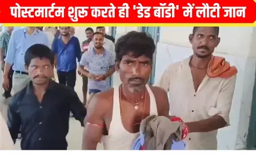 OMG: दिमाग पर चलने वाली थी ब्लेड, उससे पहले ही डेड बॉडी में आ गई जान! जिंदा देख डॉक्टर भी हैरान OMG: दिमाग पर चलने वाली थी ब्लेड, उससे पहले ही डेड बॉडी में आ गई जान! जिंदा देख डॉक्टर भी हैरान