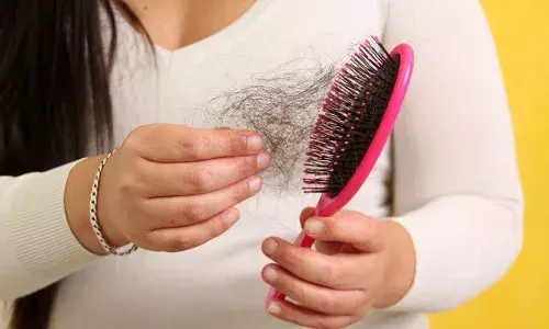 Hair Loss: 30 की उम्र में आपके भी झड़ रहे बाल, डॉक्टर ने बताए हैं बहुत काम के उपाय Hair Loss: 30 की उम्र में आपके भी झड़ रहे बाल, डॉक्टर ने बताए हैं बहुत काम के उपाय